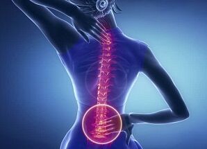 az ágyéki osteochondrosis megnyilvánulásai
